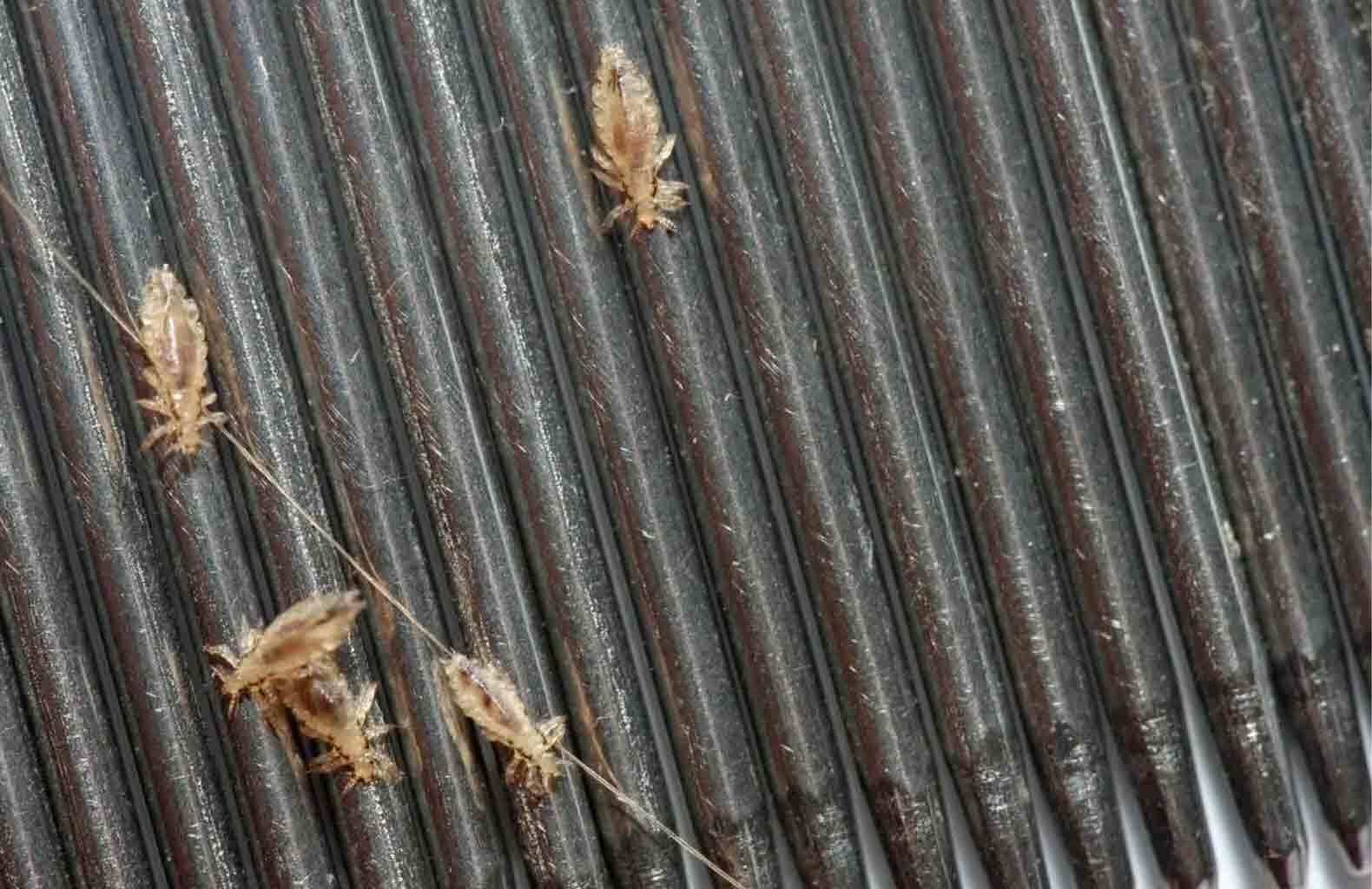 Lice pest control in Sydney by Hamro Best Pest for safe and effective lice removal