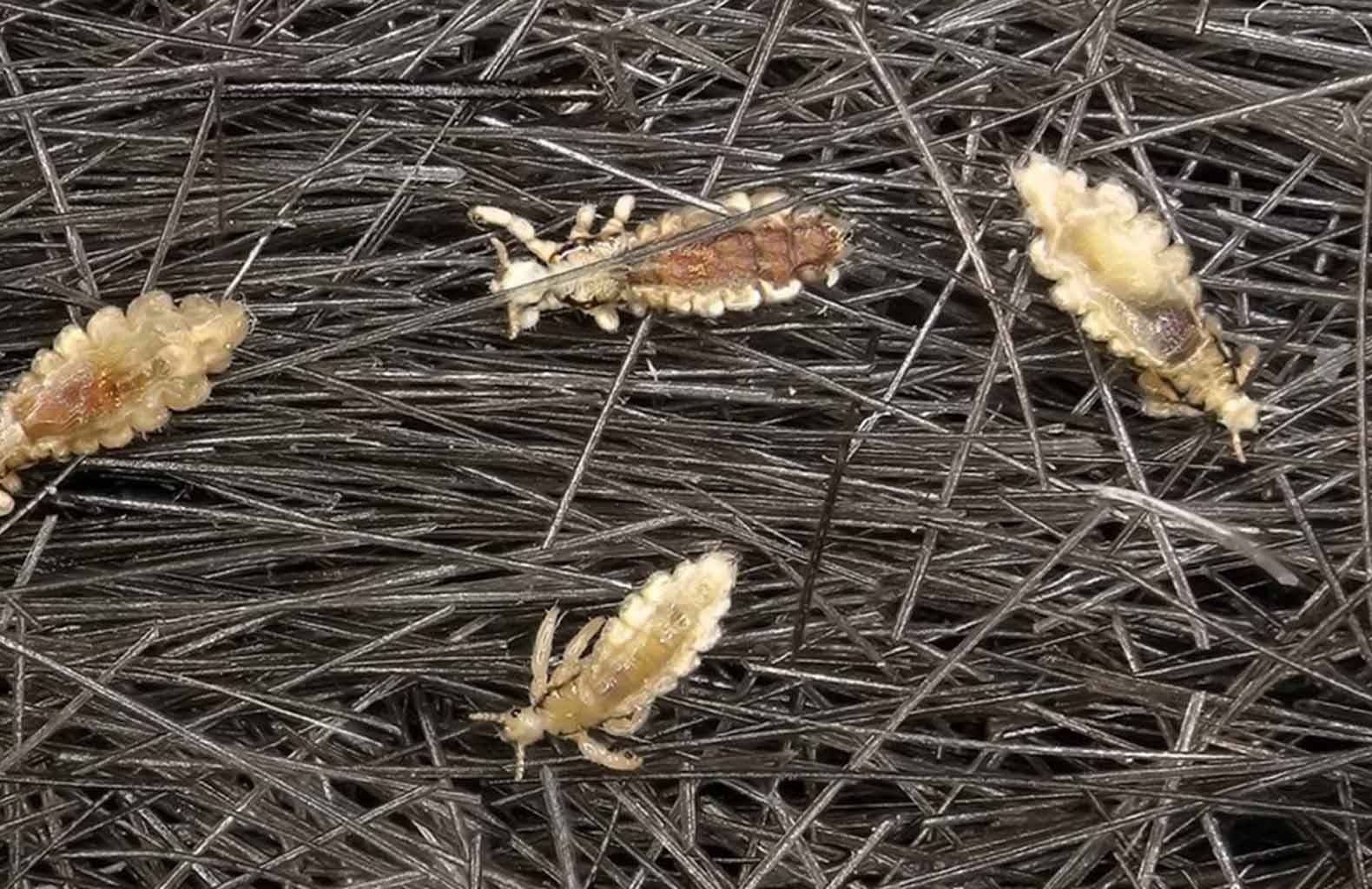 Lice pest control Sydney by Hamro Best Pest for safe and effective lice removal