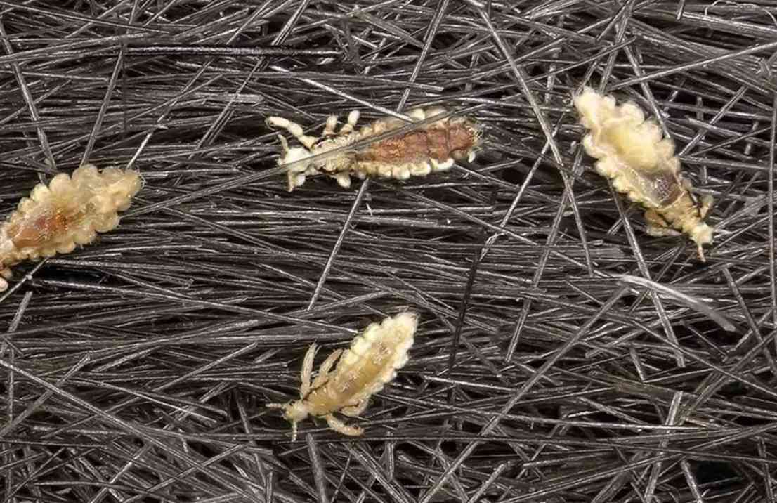 pest control expert inspecting lice infestation