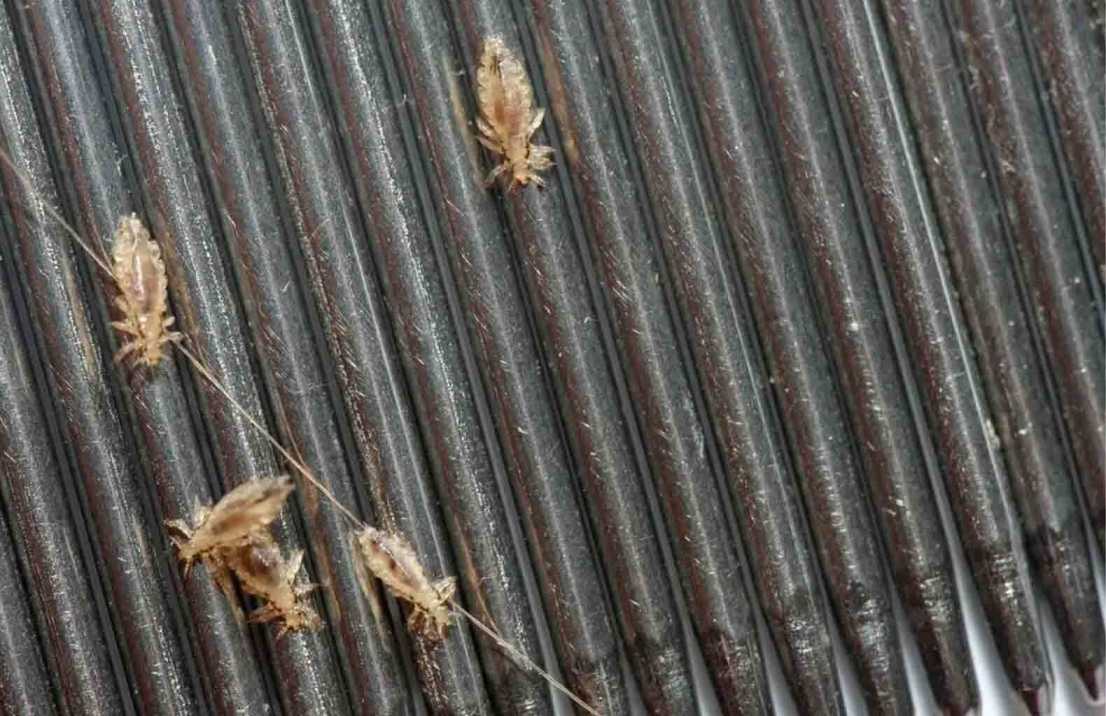 lice pest control treatment by professional technician